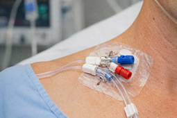 Invasive Line Incorrectly Inserted at Charing Cross Hospital